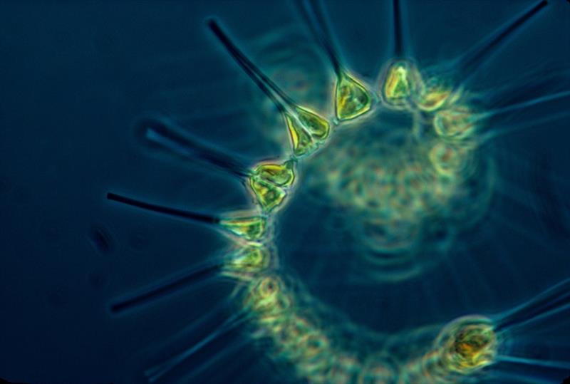 A chain-forming diatom, a common type of phytoplankton, found in the New York Bight area. - photo © NOAA Fisheries