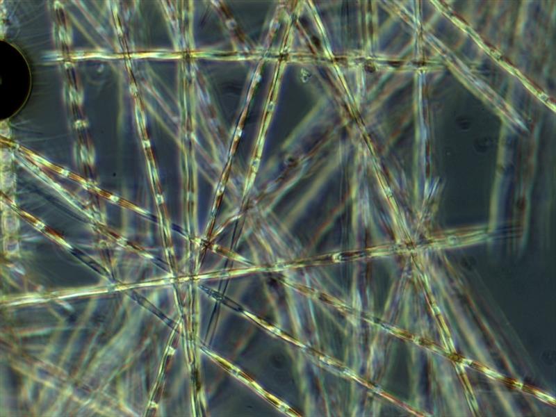 Pseudo-nitzschia, the diatom that can produce the toxin, domoic acid. - photo © NOAA Fisheries